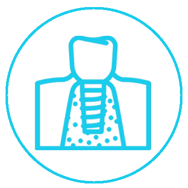 +جراحی ایمپلیمنت+