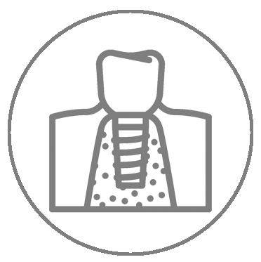 +جراحی ایمپلیمنت+