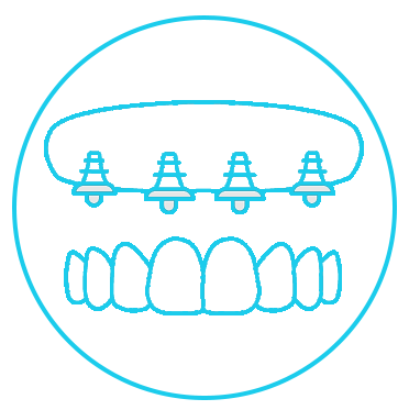 +پروتز ثابت متکی به ایپلیمنت+