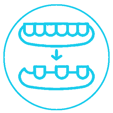 +پروتز اوردنچر+