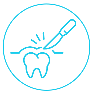 +جراحی لثه - پریو+
